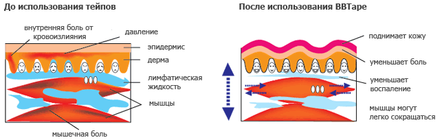 Кинезио тейп